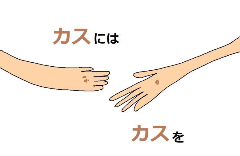 カスにはカスを