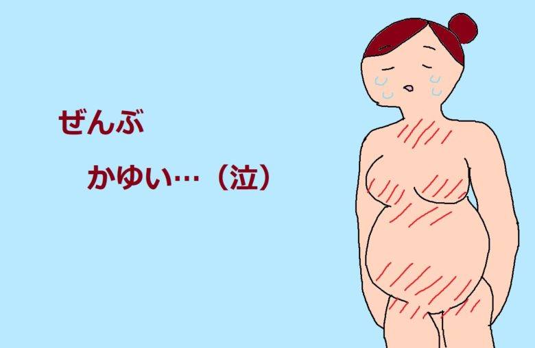 妊婦のかゆみ
