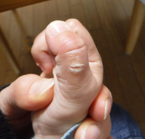 指しゃぶり卒業前